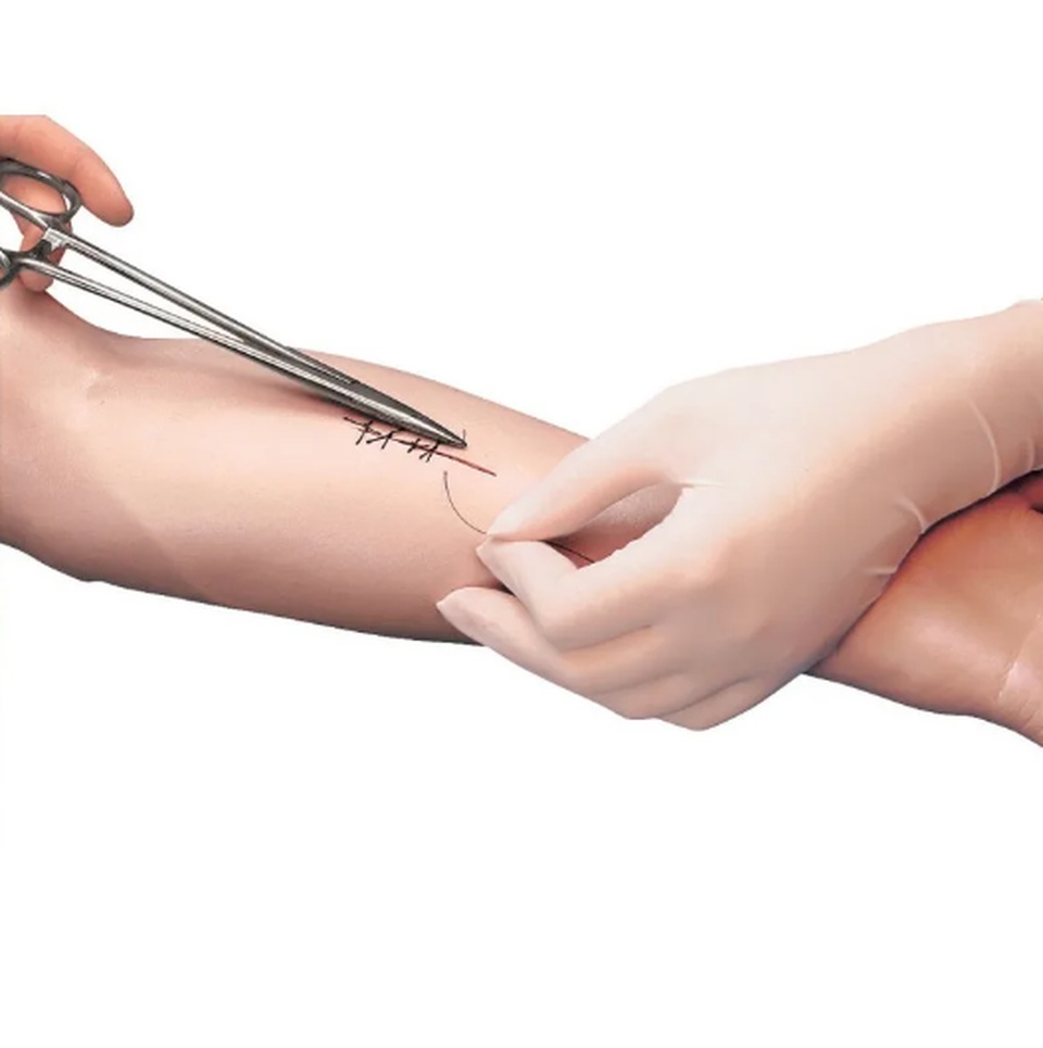 Снятие швов с хирургических ран - 500 ₽, заказать онлайн.