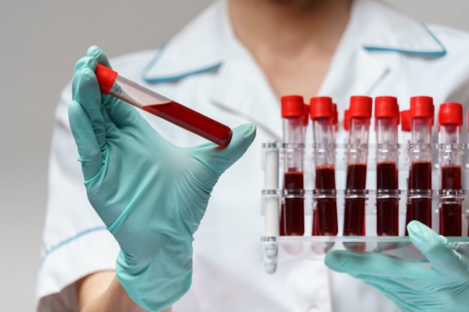 Анализ крови на протромбиновый индекс - 200 ₽, заказать онлайн.