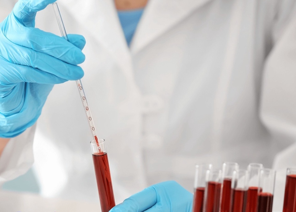 Анализ крови на мочевую кислоту - 200 ₽, заказать онлайн.
