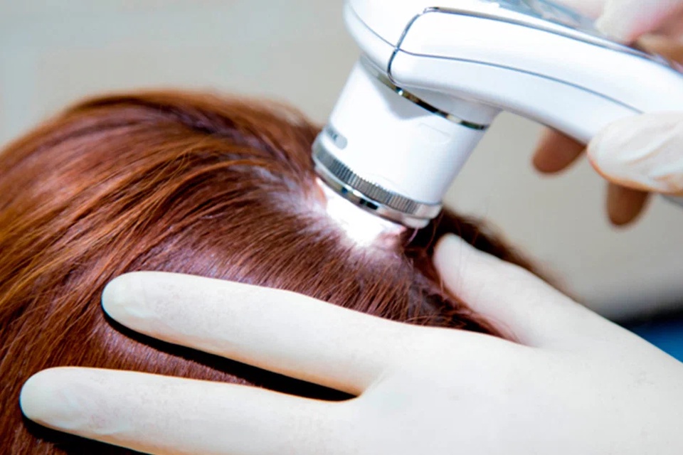 Микроскопия волос (трихометрия) - 420 ₽, заказать онлайн.